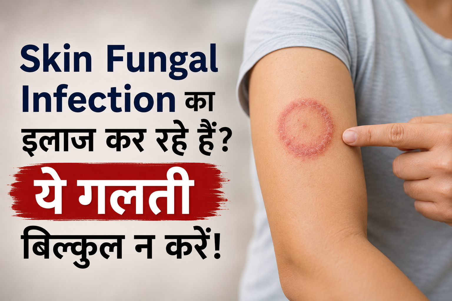skin Fungal Infection Treatment