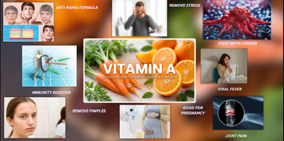 Vitamin A