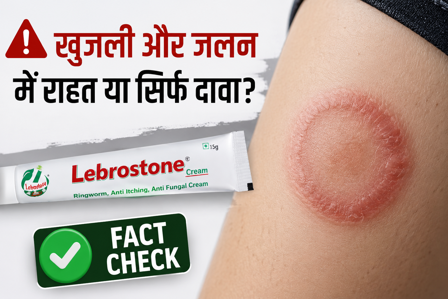 दाद और खुजली का इलाज? जानिए Lebrostone Cream के 5 चौंकाने वाले सच