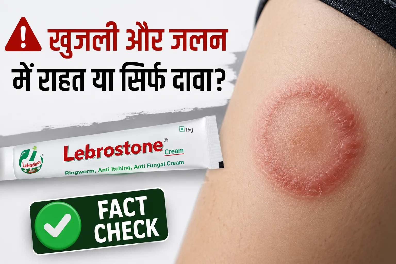 दाद और खुजली का इलाज? जानिए Lebrostone Cream के 5 चौंकाने वाले सच