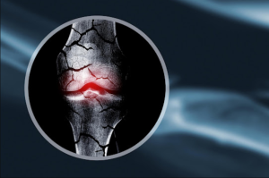 joint pain