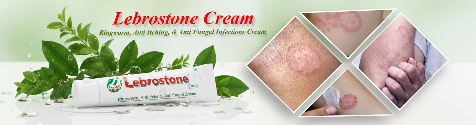 Lebrostone anti fungal cream use for ringworm 