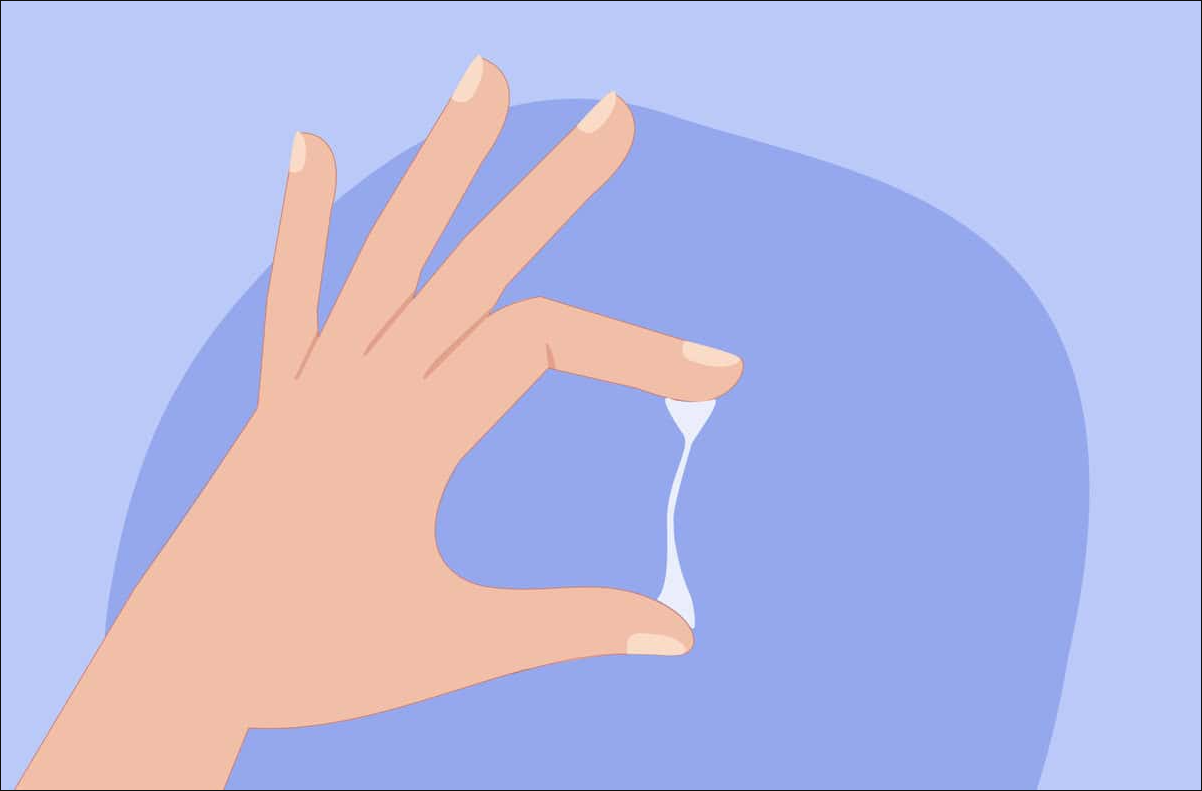 What is White Discharge