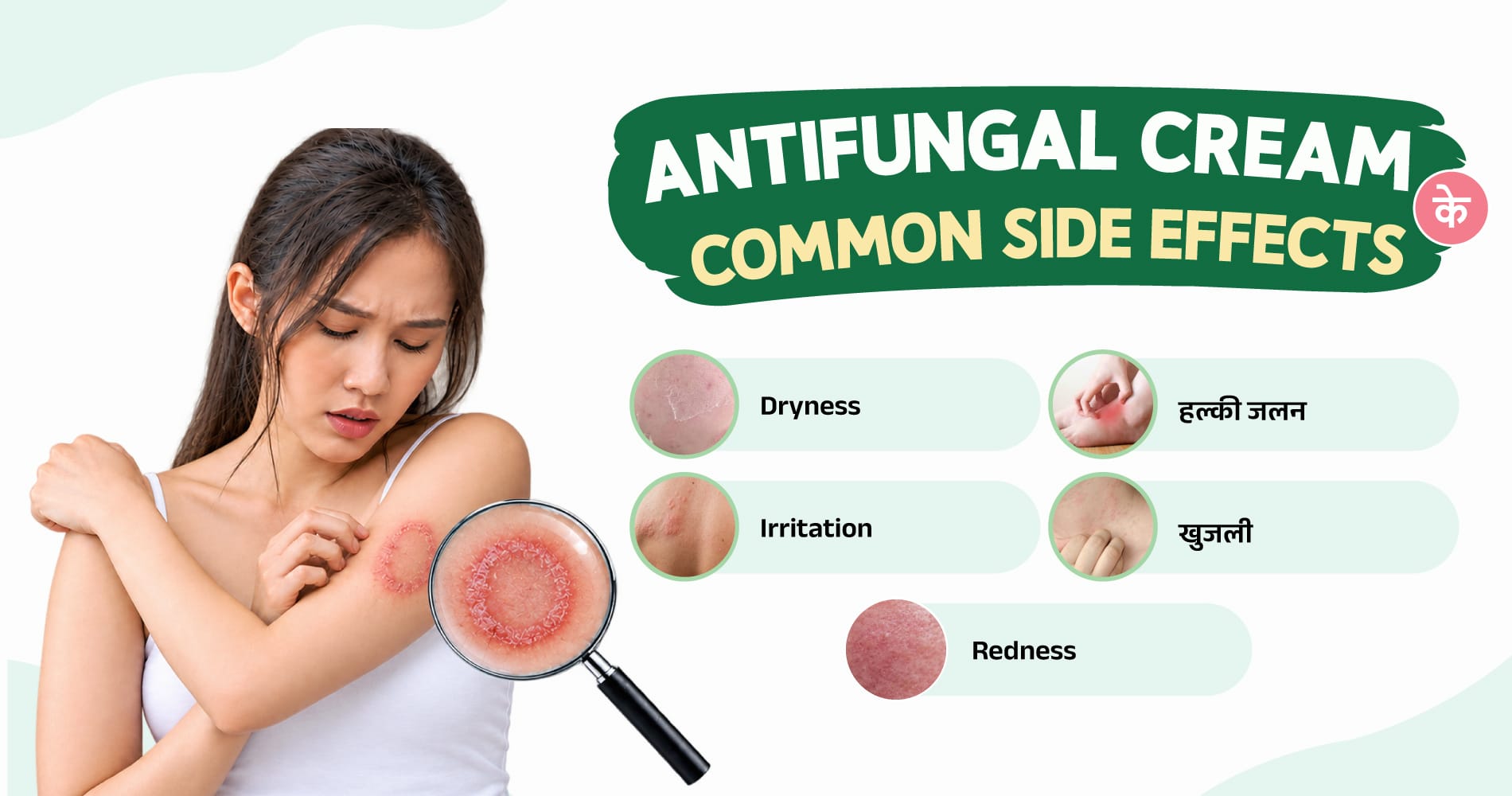 Antifungal Cream Common Side Effects
