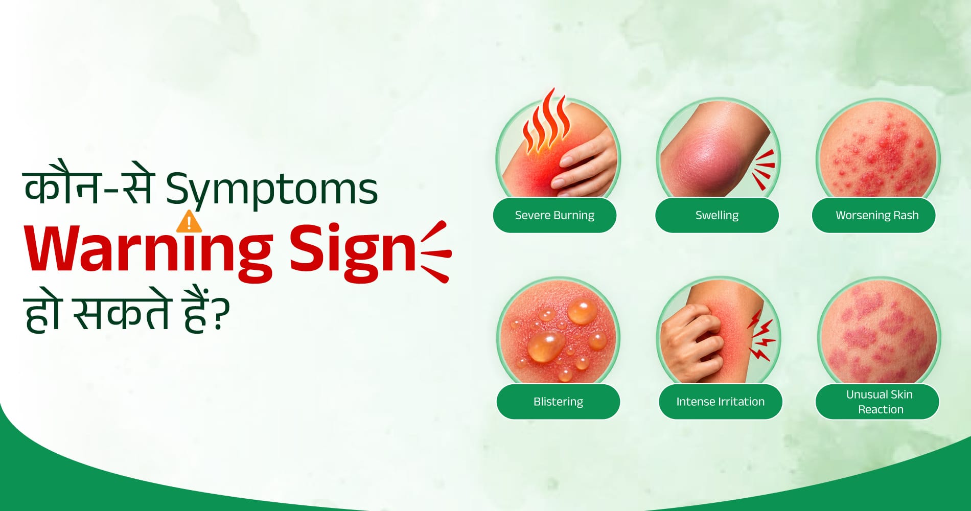 Lebrostone Antifungal Cream Serious Side Effects Warning Signs