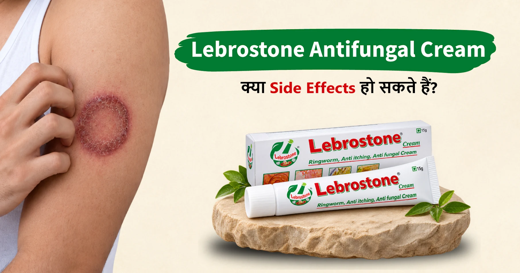 lebrostone anti fungal cream side effectes