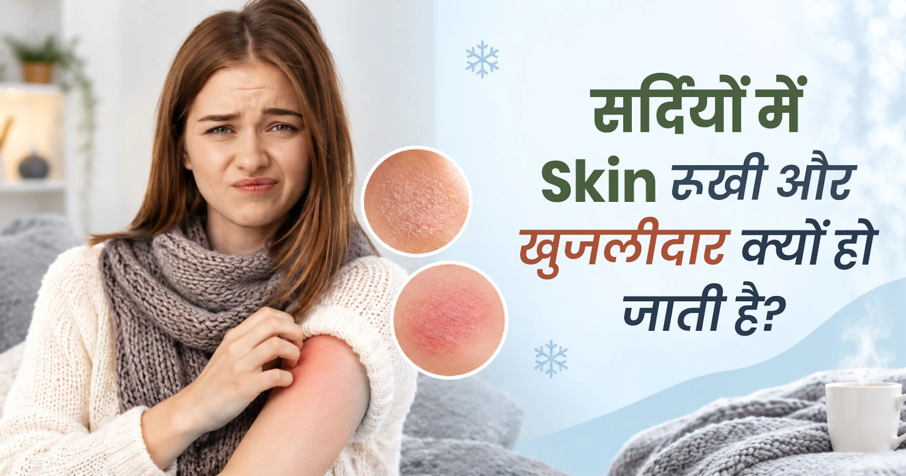 Winter Dry Skin और रात की खुजली से हैं परेशान? जानें सही Care Tips