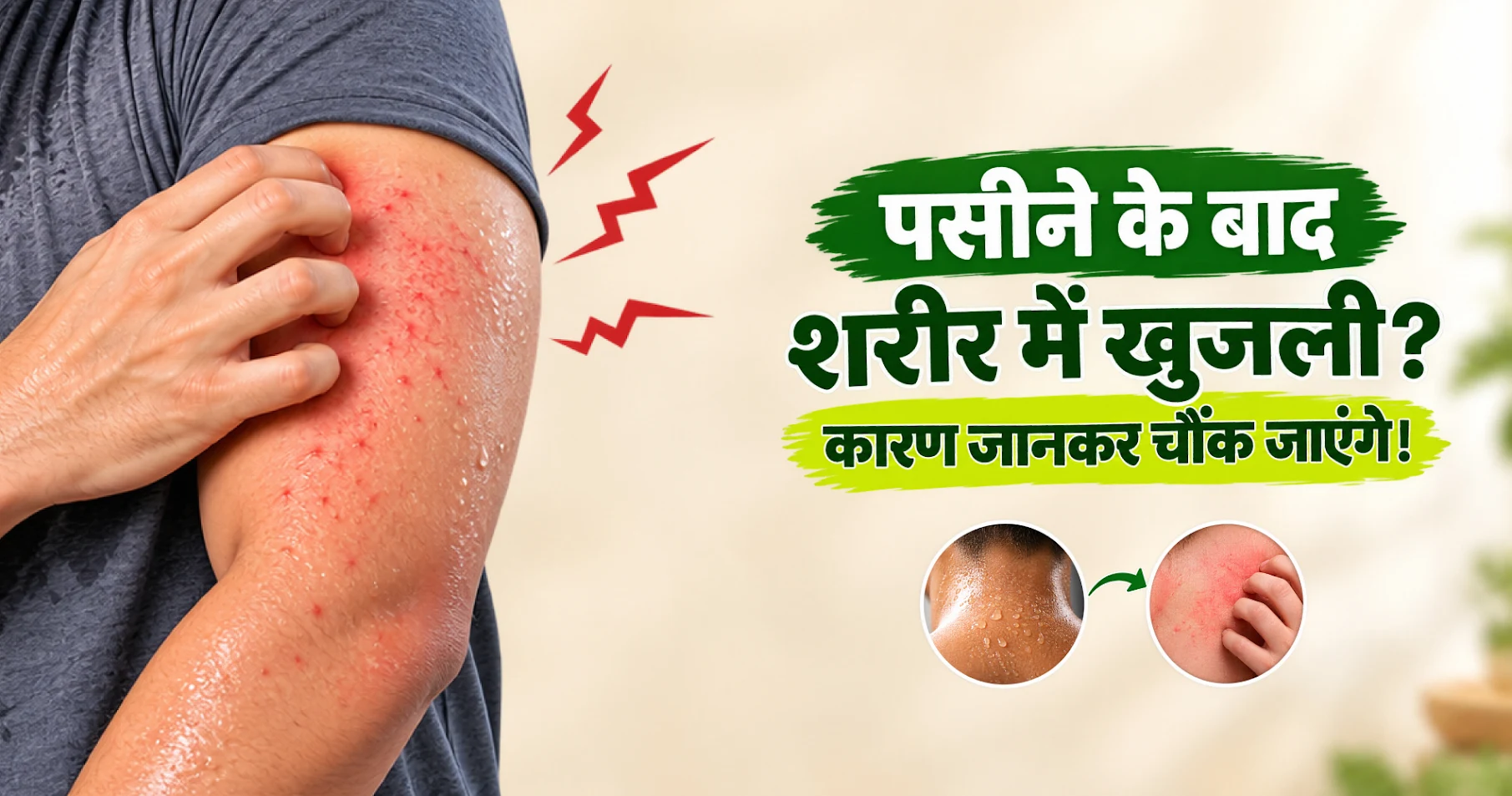 पसीने से शरीर में खुजली क्यों होती है? जानें कारण और बचाव के आसान उपाय